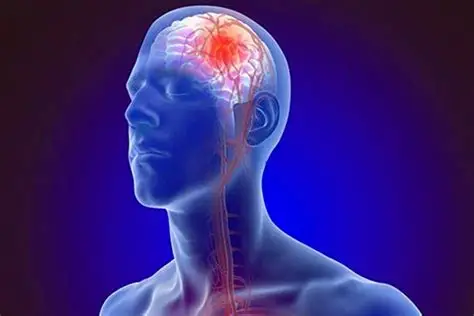Stroke Or Cerebrovascular Accident