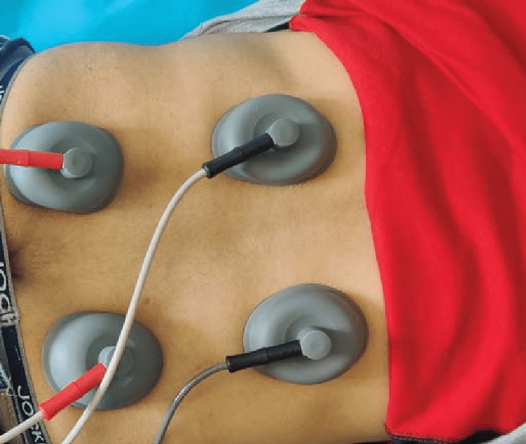 Interferential Therapy