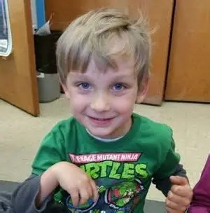 Infantile Hemiparesis