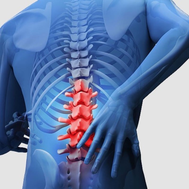 Lumbar Spondylosis
