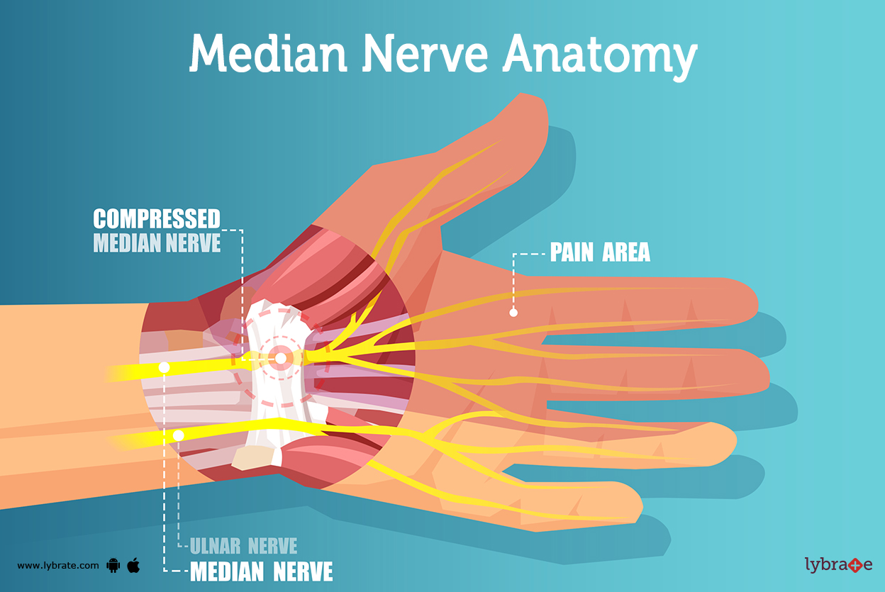 Median Nerve Injury