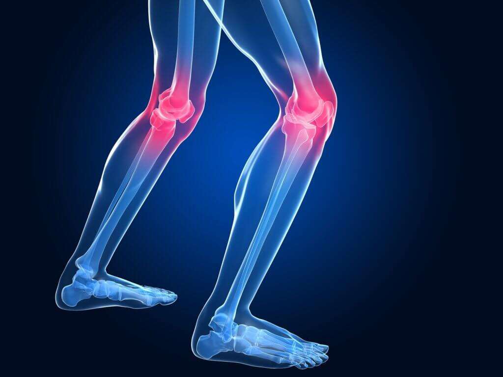 Osteoarthritis