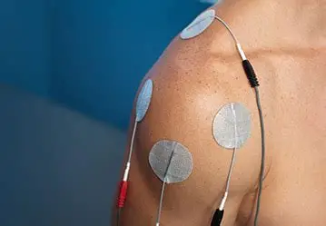 Transcutaneous Electrical Nerve Stimulation Therapy