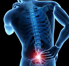 Tailbone Pain/coccydynia