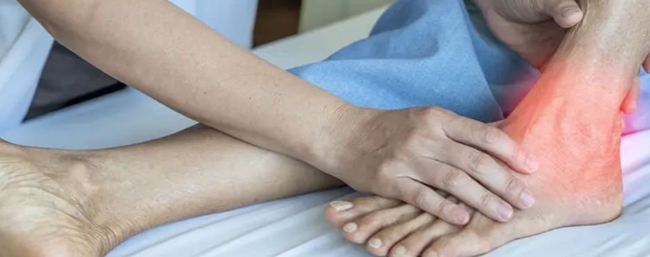 Tarsal Tunnel Syndrome